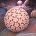 Can Genital Warts Disappear on Their Own? - An Expert's Perspective